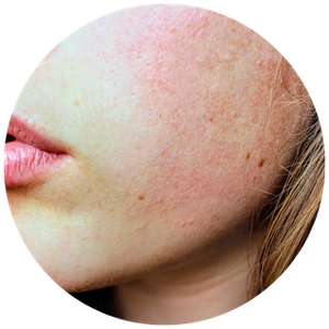 Anti-Bacterial Care