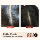 Omeo Anti Dandruff Shampoo | Pack Size 100ML & 200ML