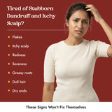 Omeo Anti Dandruff Shampoo