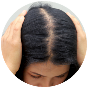 Increased Hair Fall