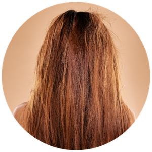 Dull Hair Appearance