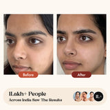 Omeo Anti Aging Cream